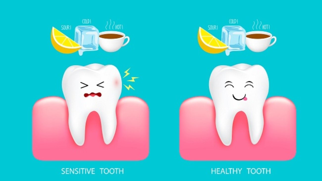 sensitive-teeth